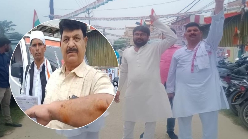 सीएम योगी के शहर में आपस में ही भिड़े कांग्रेस कार्यकर्ता और पार्टी पदाधिकारी, जमकर हुई मारपीट, 4 बड़े नेता हुए घायल