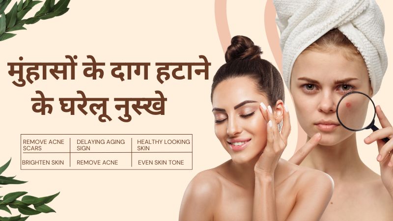 मुंहासों के जिद्दी दाग-धब्बों से पाएं तुरंत छुटकारा, दादी मां के घरेलू नुस्खों से ऐसे बनाएं साफ और ग्लोइंग स्किन