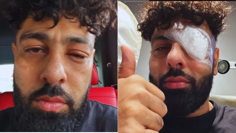 बादशाह हुए जख्मी, आंख पर बांधी पट्टी, बोले- अवतार जी का मुक्का हिट करता है