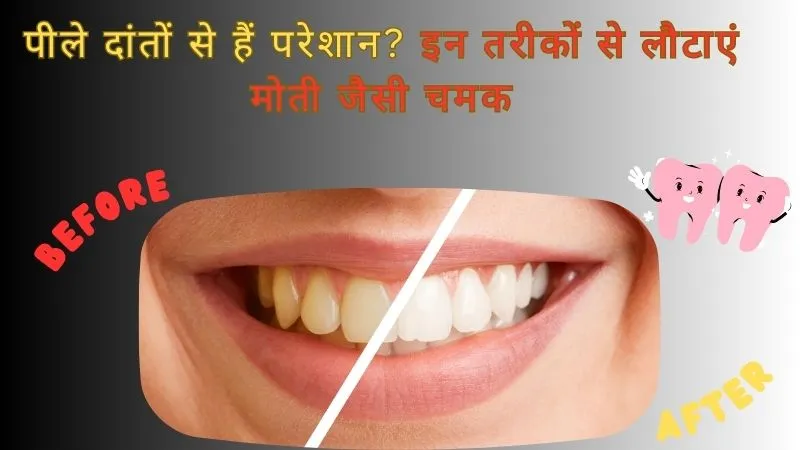 पीले दांतों से हैं परेशान? इन तरीकों से लौटाएं मोती जैसी चमक, पर इस बात का रखें ध्यान