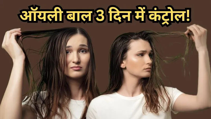 सुबह धुले बाल, दोपहर तक चिपचिपे? ऑयली स्कैल्प की असली वजहें और डॉक्टरों के बताए कंट्रोल करने के आसान तरीके