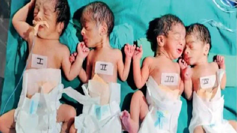 इंदौर में महिला ने एक साथ 4 बच्चों को दिया जन्म, शादी के 9 साल बाद शबनम के घर में आई खुशियाँ