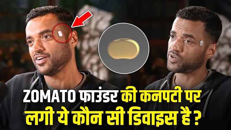 क्या है Zomato फाउंडर की कनपटी पर लगी ये 'डिवाइस', क्यों कहा जा रहा इसे अमीरों का महंगा खिलौना, जानें
