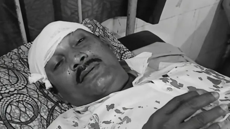 बंगाल चुनाव में खूनी संग्राम! BJP पोलिंग एजेंट का बड़ा आरोप, बोले- TMC के बदमाशों ने मेरे सिर पर रॉड से हमला किया