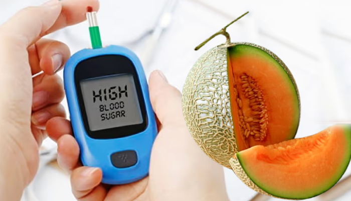Diabetes के मरीज़ों को खरबूजा खाने से होता है नुकसान या फायदा? कहीं गलती तो नहीं कर रहे आप?