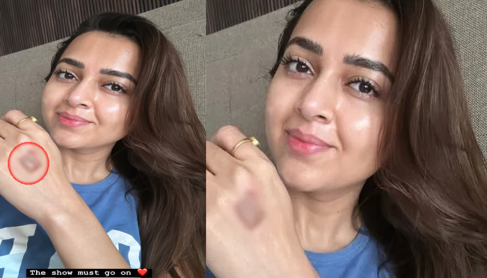 'सेलिब्रिटी मास्टरशेफ' के  सेट पर शूटिंग के दौरान घायल हुईं तेजस्वी प्रकाश ,सोशल मीडिया पर दी जानकारी