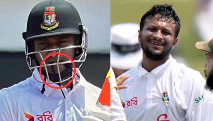 IND vs BAN टेस्ट मैच में शाकिब अल हसन ने मुंह पर काला बैंड क्यों लगाया?