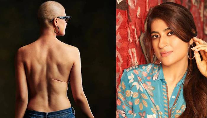Tahira Kashyap को सात साल बाद फिर हुआ कैंसर, बोलीं 'यह मेरा राउंड-2'