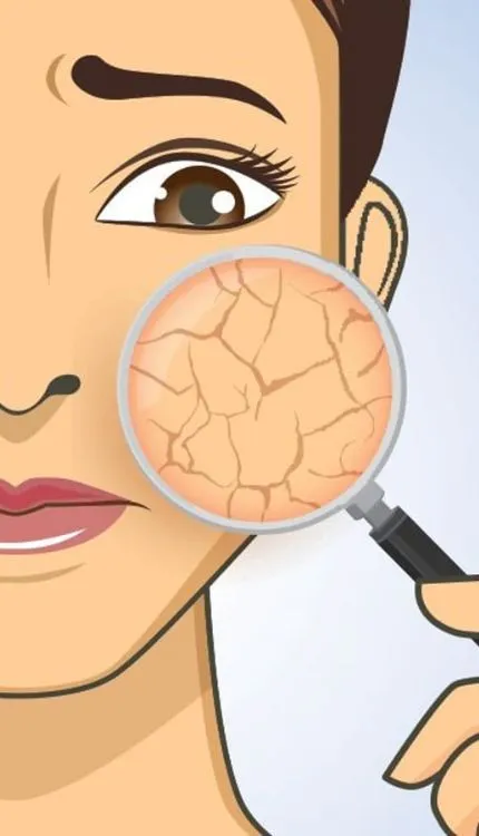 सर्दियों में ड्राय स्किन से बचना है आसान! चेहरे पर लगाएं ये 5 चमत्कारी तेल और पाएं मुलायम त्वचा